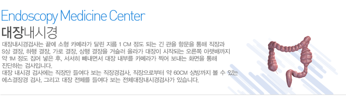 대장내시경검사는 끝에 소형 카메라가 달린 지름 1 cm 정도 되는 긴 관을 항문을 통해 직장과 S상 결장, 하행 결장, 가로 결장, 상행 결장을 거슬러 올라가 대장이 시작되는 오른쪽 아랫배까지 약 1m 정도 집어 넣은 후, 서서히 빼내면서 대장 내부를 카메라가 찍어 보내는 화면을 통해 진단하는 검사입니다.
대장 내시경 검사에는 직장만 들여다 보는 직장경검사, 직장으로부터 약 60cm 상방까지 볼 수 있는 에스결장경 검사, 그리고 대장 전체를 들여다 보는 전체대장내시경검사가 있습니다.  